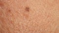 A close up of human skin with a small dark mole or spot Royalty Free Stock Photo