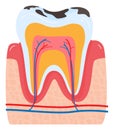 Close up of a human tooth cross section showing enamel, dentin, pulp, and gum. Dental anatomy and health care vector