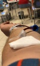 Close-up image of a man who is donating blood in a health care hospital.