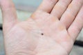 A close-up on ixodes scapularis, blacklegged tick or deer tick, transmitter of lyme and borrelia disease on a man`s palm