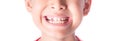 Close up of kid toothless Royalty Free Stock Photo