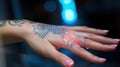 Close-up of laser tattoo removal from woman hand