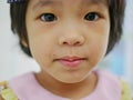 Little Asian baby girl allergic face with skin rashes Royalty Free Stock Photo