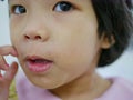 Close up of little Asian baby girl scratching on her allergic face, as it got rashes making her facial skin dry, and itchy