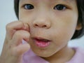 Close up of little Asian baby girl scratching on her allergic face, as it got rashes making her facial skin dry, and itchy