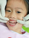 Close-up little girl during dental extraction. Child with a teeth broken and rotten