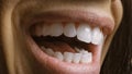 Close Up Macro Shot of a Mouth with Perfect White Teeth. Person Laughs with Opened Mouth Royalty Free Stock Photo