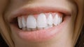 Close Up Macro Shot of a Mouth with Perfect White Teeth. Person Smiles. Female with Beat Royalty Free Stock Photo