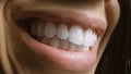 Close Up Macro Shot of a Mouth with Perfect White Teeth. Person Smiles. Female with Beat Royalty Free Stock Photo