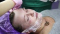 face having a laser skin treatment, a resurfacing technique for wrinkles