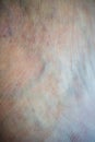 Close up macro of Skin with varicose veins background
