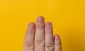 Close up Male fingers with bitten, gwaned, chewed or ugly nails, a Bit bad nail and isolated on a yellow background