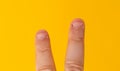 Close up Male two fingers with bitten, gwaned, chewed or ugly nails, a Bit bad nail and isolated on a yellow background