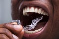 Man Adjusting Transparent Aligners In His Teeth Royalty Free Stock Photo