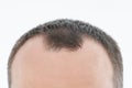 Close up of man bold head Royalty Free Stock Photo