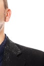 Close up from a man with a dandruff problem Royalty Free Stock Photo
