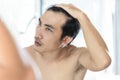 Close up man looking reflection in the mirror serious hair loss problem for health care shampoo and beauty product concept