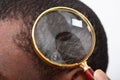 Man`s Hair Seen Through Magnifying Glass Royalty Free Stock Photo