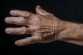 a close up of a mans hand with wrinkled skin