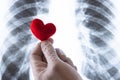 Close-up of a medic`s hand. A doctor or a laboratory assistant in a white glove holds a souvenir red heart over an x-ray of the Royalty Free Stock Photo