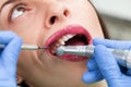 Close-up medical dentist procedure of teeth polish Royalty Free Stock Photo