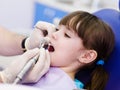 Close-up medical dentist procedure of teeth polish Royalty Free Stock Photo