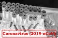 Close-up of medical test tube. Coronavirus 2019-nCoV Stamp