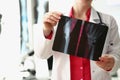 Medical worker analyzing patient hand xray result, injury