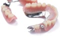 Close-up metal removable partial denture on white background Royalty Free Stock Photo