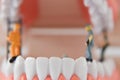 Close-up of miniature people worker cleaning tooth model as medical and healthcare