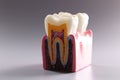 Mock tooth in section, educational model of tooth, anatomy of human oral tooth