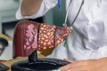 Close up of model of human liver with words normal, fibrotic, cirrhotic, cancerous. female doctor shows the patient a Royalty Free Stock Photo