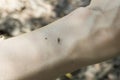 close-up: a mosquito on the human wrist Royalty Free Stock Photo