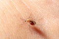 Mosquito sucked blood on human skin