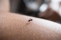 Close up of mosquito sucking blood on human skin, the saliva of