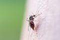 a mosquito sucks blood from a human body. macro photo of a mosquito on the arm Close up a Mosquito sucking human blood set B-2 Royalty Free Stock Photo