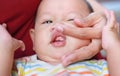 Close-up mother hands open baby mouth to examine first teeth. Infant primary tooth