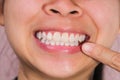 Close up of mouth of happy Asian woman touching the corners of her mouth with index finger while smiling broadly revealing her Royalty Free Stock Photo