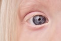 Close-up mystic photo of albino child eye