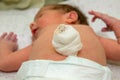 Close up of navel newborn baby boy. Close up umbilical cord. Umbilical cord with bandage Royalty Free Stock Photo