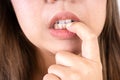 Close up nervous woman biting her nails, stressful woman gnawing her nails Royalty Free Stock Photo