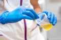 Close up of Nurse Hand holding urine sample container for medical urine analysis with color strip. Royalty Free Stock Photo