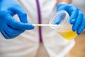 Close up of Nurse Hand holding urine sample container for medical urine analysis with color strip. Royalty Free Stock Photo