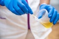 Close up of Nurse Hand holding urine sample container for medical urine analysis with color strip. Royalty Free Stock Photo