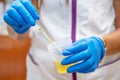 Close up of Nurse Hand holding urine sample container for medical urine analysis with color strip. Royalty Free Stock Photo