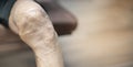 Close up of old man hand holding on the knee with suffering from knee pain. The sick legs of an old man with severely deformed Royalty Free Stock Photo