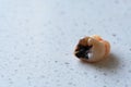 one removed human decayed wisdom tooth