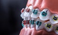 Close-up of a orthodontic model jaws and teeth with braces Royalty Free Stock Photo