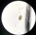 Close up parasite in stool exam.