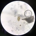 Close up parasite in stool exam.